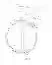 Fig. 06 - Method and device for ocular alignment and coupling of ocular structures