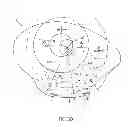 Fig. 07 - Method and device for ocular alignment and coupling of ocular structures