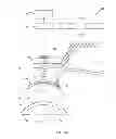 Fig. 08 - Method and device for ocular alignment and coupling of ocular structures