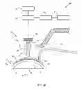 Fig. 09 - Method and device for ocular alignment and coupling of ocular structures
