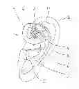 Fig. 01 - Device for the combined application of a transcutaneous electrical stimulus and emission of an acoustic signal