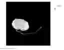 Fig. 01 - Systems and methods for performing truncation artifact correction