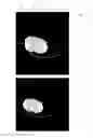 Fig. 05 - Systems and methods for performing truncation artifact correction