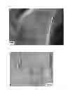 Fig. 06 - Oxygen atom-dispersed metal matrix composite and method of manufacturing the same