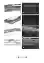 Fig. 03 - Method and Composition for Skin Grafts