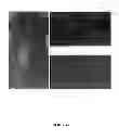 Fig. 10 - Method and Composition for Skin Grafts