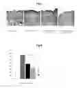 Fig. 04 - Composition for preventing or alleviating skin wrinkles containing honeybush extract or fermented honeybush as an active ingredient