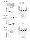Fig. 16 - Compositions and methods for treating or preventing lupus