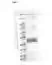 Fig. 09 - CLOSTRIDIUM DIFFICILE ANTIGENS