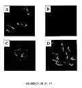 Fig. 04 - PHARMACEUTICAL COMPOSITIONS AND METHODS TO VACCINATE AGAINST CANDIDIASIS