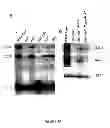 Fig. 07 - PHARMACEUTICAL COMPOSITIONS AND METHODS TO VACCINATE AGAINST CANDIDIASIS