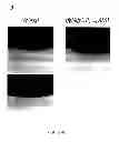 Fig. 08 - PHARMACEUTICAL COMPOSITIONS AND METHODS TO VACCINATE AGAINST CANDIDIASIS