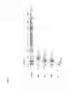Fig. 02 - Genes of an otitis media isolate of nontypeable 