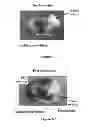 Fig. 03 - Pharmaceutical composition for treating ischemic events