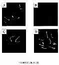 Fig. 04 - Pharmaceutical compositions and methods to vaccinate against candidiasis