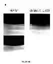 Fig. 08 - Pharmaceutical compositions and methods to vaccinate against candidiasis