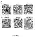 Fig. 10 - Pharmaceutical compositions and methods to vaccinate against candidiasis
