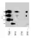 Fig. 08 - Computationally optimized broadly reactive antigens for H1N1 influenza