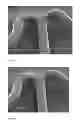 Fig. 02 - Implantable device having a coating with a triblock copolymer