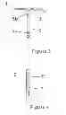 Fig. 03 - Intrauterine delivery system for contraception