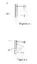 Fig. 04 - Intrauterine delivery system for contraception