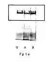 Fig. 02 - Cosmetic composition for use in increasing the collagen synthesis in skin cells