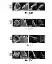 Fig. 09 - Adjuvant incorporation in immunoanotherapeutics