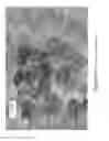 Fig. 09 - MICROPELLET COMPOSITIONS COMPRISING PANCREATIN CONTAINING DIGESTIVE ENZYME MIXTURE