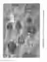 Fig. 10 - MICROPELLET COMPOSITIONS COMPRISING PANCREATIN CONTAINING DIGESTIVE ENZYME MIXTURE