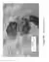 Fig. 16 - MICROPELLET COMPOSITIONS COMPRISING PANCREATIN CONTAINING DIGESTIVE ENZYME MIXTURE
