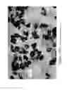 Fig. 25 - MICROPELLET COMPOSITIONS COMPRISING PANCREATIN CONTAINING DIGESTIVE ENZYME MIXTURE