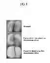 Fig. 02 - COMPOSITION CONTAINING CHRYSANTHEMUM INDICUM L. EXTRACT FOR PREVENTING DISCOLORATION