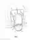 Fig. 02 - Orthodontic bracket having a biased slide member