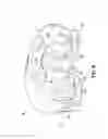 Fig. 07 - Orthodontic bracket having a biased slide member