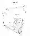 Fig. 30 - Dental treatment diagnostic method, method for calculating determination indicators, program and computer