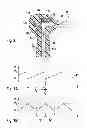 Fig. 03 - Oral Irrigator