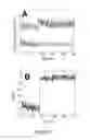 Fig. 06 - Signal amplification methods for the imaging of protein synthesis and neurotransmitter transport