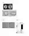 Fig. 07 - KIT FOR DIAGNOSING CARDIOMYOPATHY AND METHOD FOR PREDICTING CARDIOMYOPATHY