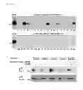Fig. 02 - Human autoantibodies specific for PAD3 which are cross-reactive with PAD4 and their use in the diagnosis and treatment of rheumatoid arthritis and related diseases