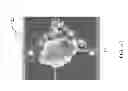 Fig. 09 - EX VIVO MICROFLUIDIC ANALYSIS OF BIOLOGIC SAMPLES