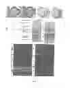 Fig. 18 - WISE/SOST NUCLEIC ACID SEQUENCES AND AMINO ACID SEQUENCES