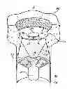 Fig. 01 - Golf cup guard
