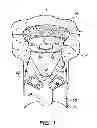 Fig. 02 - Golf cup guard