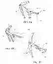 Fig. 06 - Mechanical broadheads with hinged front blades