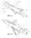Fig. 02 - Mechanical broadheads with hinged rear blades