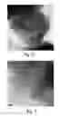 Fig. 06 - Mesoporous zeolite catalyst supports