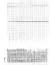 Fig. 17 - Primers and probes for detection and discrimination of types and subtypes of influenza viruses