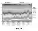 Fig. 46 - METHODS OF PROMOTING WEIGHT LOSS AND ASSOCIATED ARRAYS