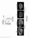 Fig. 50 - Undercarboxylated/uncarboxylated osteocalcin increases beta-cell proliferation, insulin secretion, insulin sensitivity, glucose tolerance and decreases fat mass