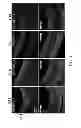 Fig. 02 - Methods for promoting neuronal outgrowth by insulin-like growth factor binding protein-like 1 (IGFBPL-1) in glaucoma or leber's optic neuropathy